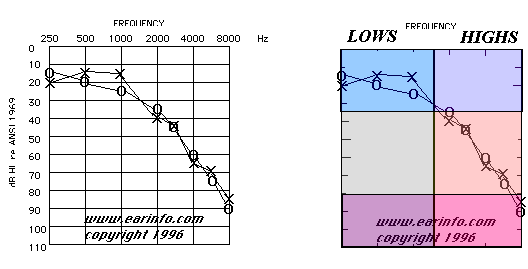 zrób test słuchu